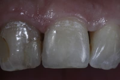  mg 1253 dh3biw - Eugenol