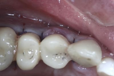  mg 1545 zgqwqq - Eugenol