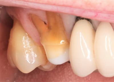  mg 1722 imojid - Eugenol