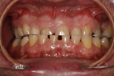  mg 1814  1024x768  cq2koq - Eugenol