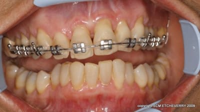  mg 1849 zttgso - Eugenol