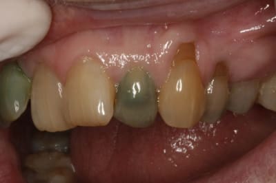  mg 1909  50   quwtfb - Eugenol