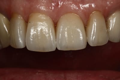  mg 2204 anhfez - Eugenol