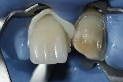  mg 3126 oqqhue - Eugenol