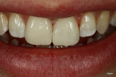  mg 3626 zjljge - Eugenol