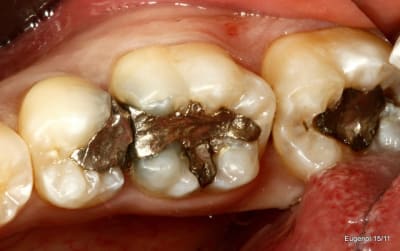  mg 5029 001 wvhwhv - Eugenol