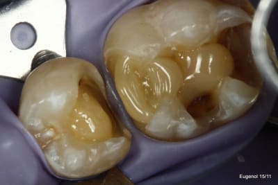  mg 5041 001 cgt4au - Eugenol