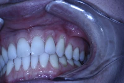  mg 5289 1 gst6rb - Eugenol