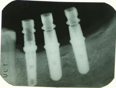  mg 6745 zweq11 - Eugenol