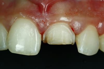  mg 7488 crgqhp - Eugenol