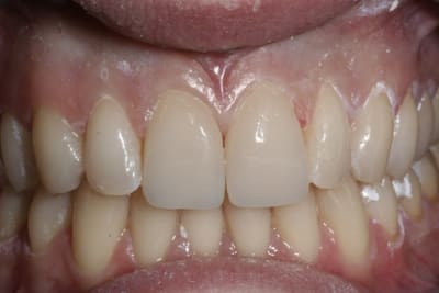  mg 7689 trwxb8 - Eugenol
