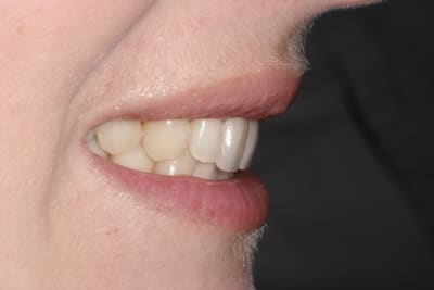  mg 7706 ndnilo - Eugenol