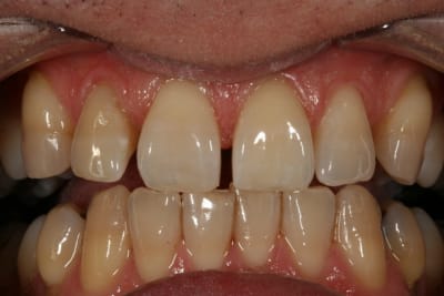  claircissement 21 apr s lannpu - Eugenol