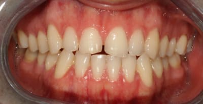  rosion 1 1 xer1gl - Eugenol