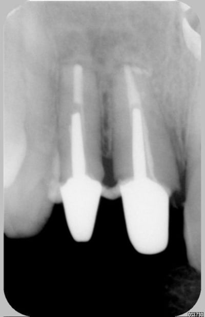 A 1 an ww5rtp - Eugenol