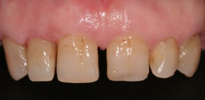 Aa xnriw2 - Eugenol