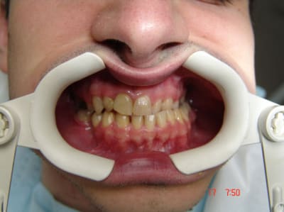 Ac3 vvb6ab - Eugenol