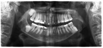 Agddeisfosxr0lnebbbm - Eugenol