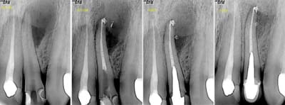 Ahd owogll - Eugenol