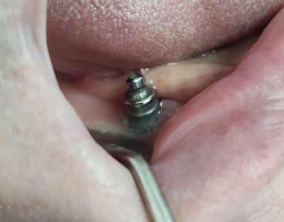 Aio1dpisteqqlzvxq0en - Eugenol