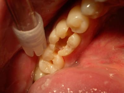 Alibaba hkshhc - Eugenol