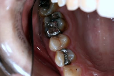 Amaris4 tlwbpu - Eugenol