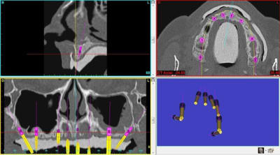 Aper u yny3pz - Eugenol