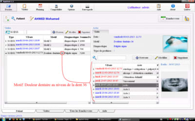 Appdent13 1 smqjlj - Eugenol