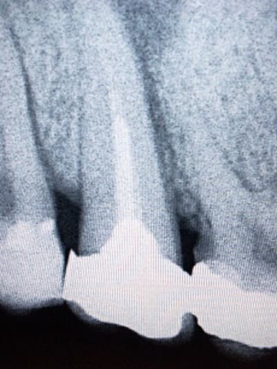 Après u9d1om - Eugenol