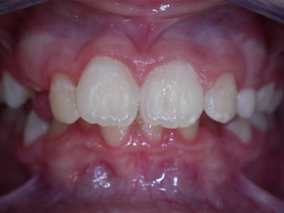 Apr s qh lhtdbu - Eugenol