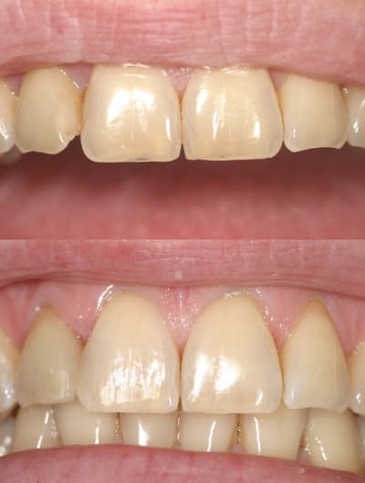 Av ap web jcolqd - Eugenol