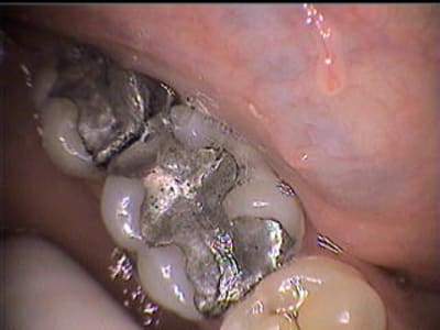 Av wzcnbu - Eugenol