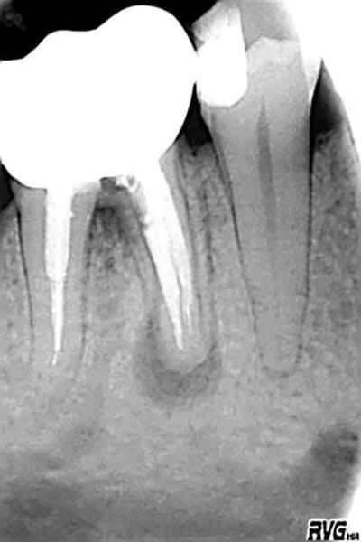 Avant 24062003 ex7dhe - Eugenol