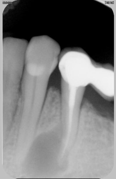 Avant e4shuv - Eugenol