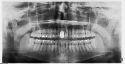 Avant ufs2h1 - Eugenol