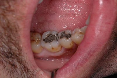 Avant xen5gj - Eugenol