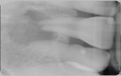 Avant xzcl7i - Eugenol