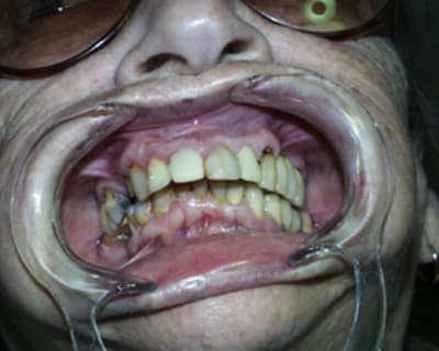 Aya7 t3ryck - Eugenol