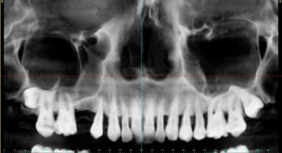 Baron audrey aper u10 ws65z0 - Eugenol