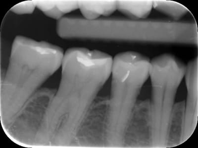 Berr rad cwy3sm - Eugenol