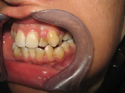 Bilan orthodontie hanguag sihm 006 jld6be - Eugenol