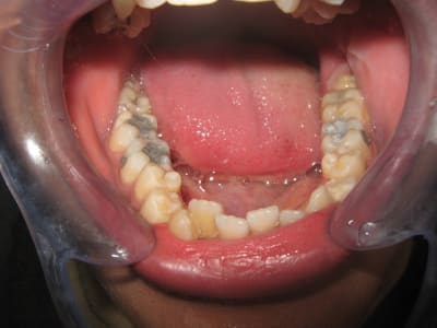 Bilan orthodontie hanguag sihm 009 vzhddc - Eugenol