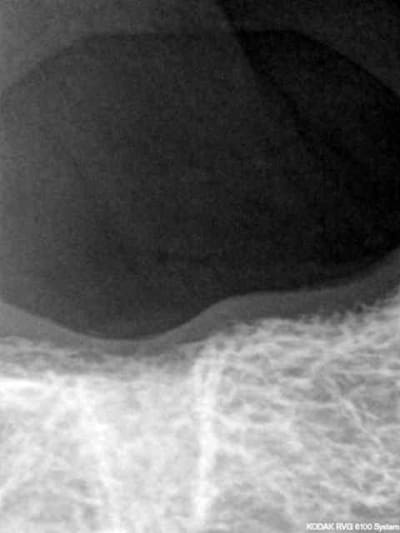 Biphospho uok5ra - Eugenol