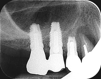 Bleemno6j27sgpqbp1iz25ngnsg8 - Eugenol