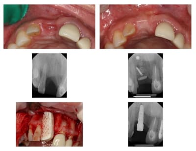 Bloc 11 pwaj8m - Eugenol