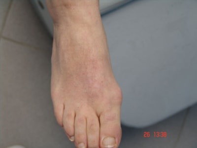 Bn2 ezgfmd - Eugenol