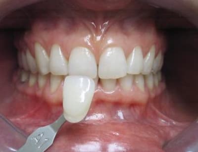 Bogeblancavt gvm0b2 - Eugenol