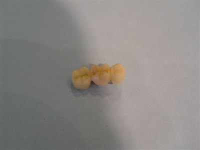 Bridge temp 2 vnlvg1 - Eugenol