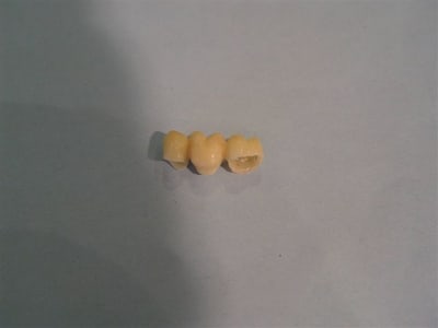 Bridge temp xo1rm4 - Eugenol