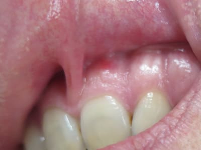 Brjb37az4blniiekprfo - Eugenol